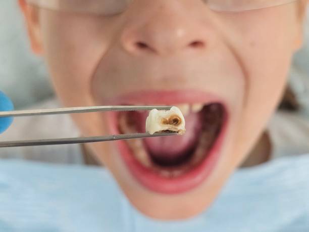 Best Emergency Denture Repair in Lawrence, KS