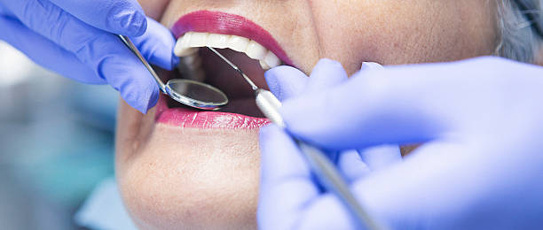 Best Dental Abscess Treatment in Lawrence, KS